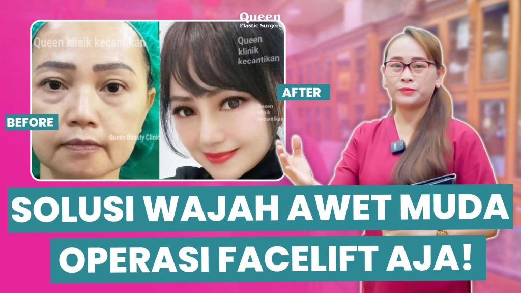Usia Bertambah, Wajah Tetap Kencang: Perubahan Faktor Usia yang Dapat Diatasi Dengan Facelift