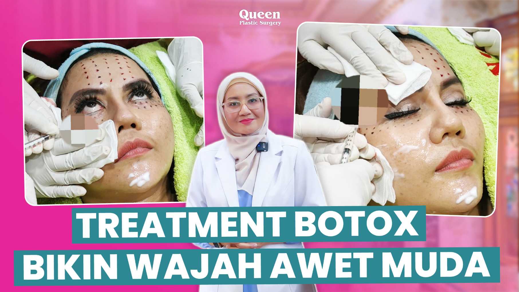 Wajah V-Shape Ideal Tanpa Bedah Dengan BOTOX Rahang! Coba Sekarang!
