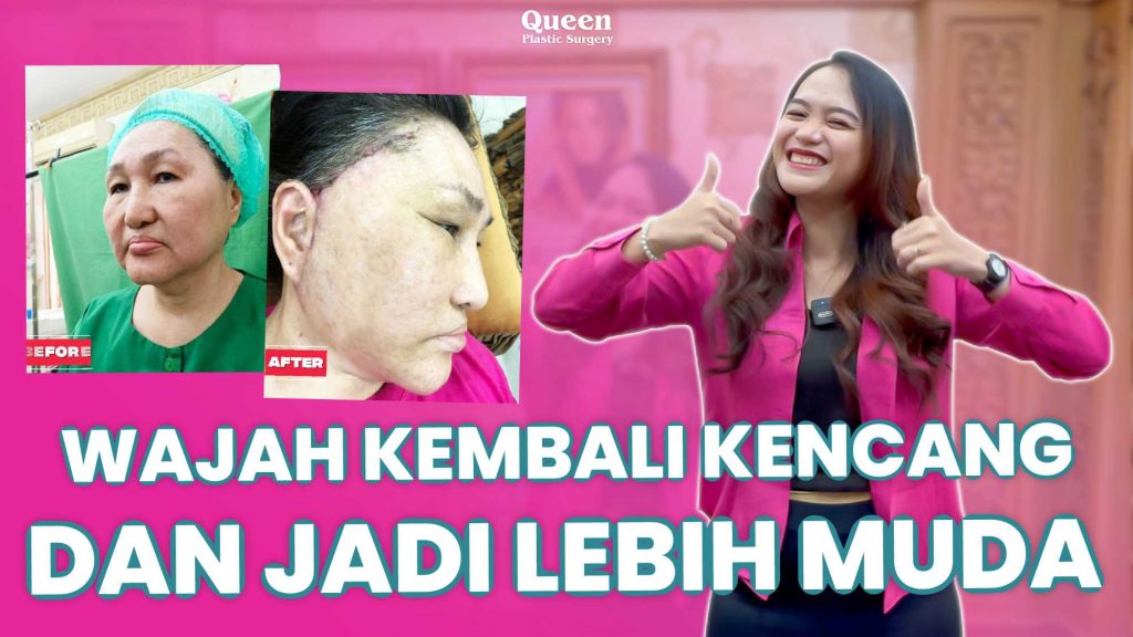 Ingin Wajah Kencang Alami? Rahasia Facelift Endoskopi Terungkap!