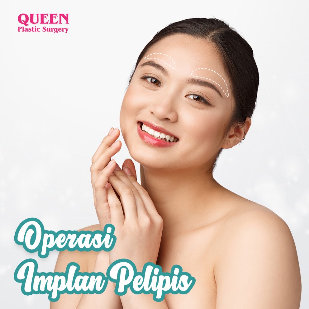 Ini Dia Alasan Kuat Mengapa Anda Perlu Pertimbangkan Operasi Pengencangan Pelipis (Forehead Lift)
