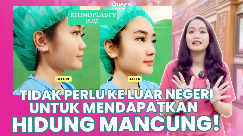 Bekas Luka Setelah Operasi Hidung? Ini Rahasia Perawatannya!