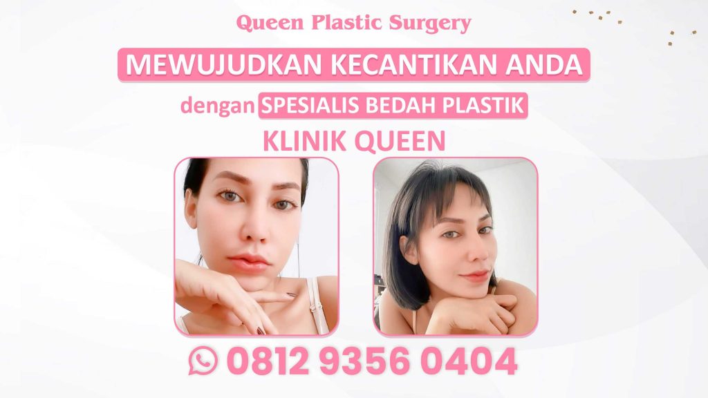 Menggabungkan Rhinoplasty dengan Prosedur Bedah Plastik Lain untuk Estetika Wajah Menyeluruh