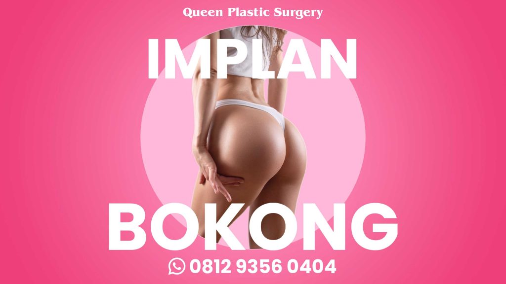 Fakta Keamanan Operasi Implan Bokong yang Wajib Anda Tahu