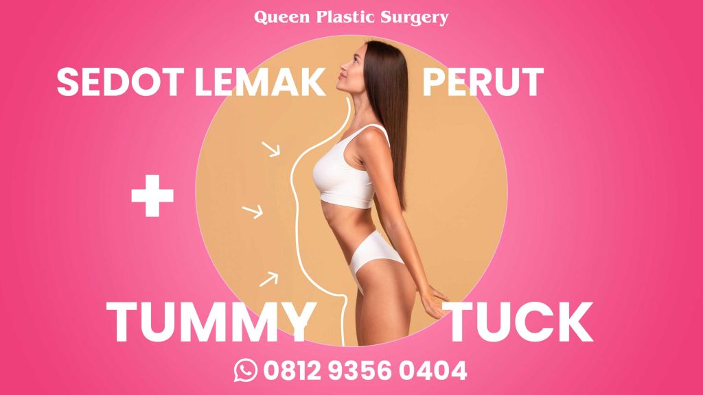 Kapan Waktu Terbaik untuk Sedot Lemak? Temukan Momen Idealmu!