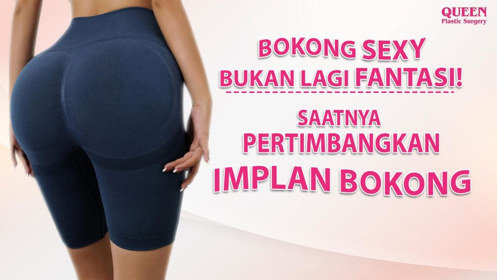 Bokong Sexy Bukan Lagi Fantasi! Saatnya Pertimbangkan Implan Bokong