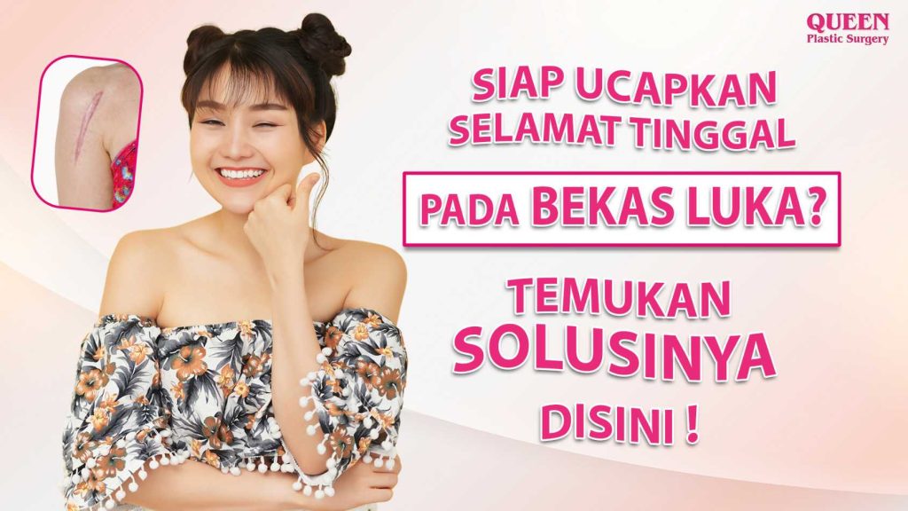 Siap ucapkan selamat tinggal pada bekas luka? Temukan solusinya di sini!