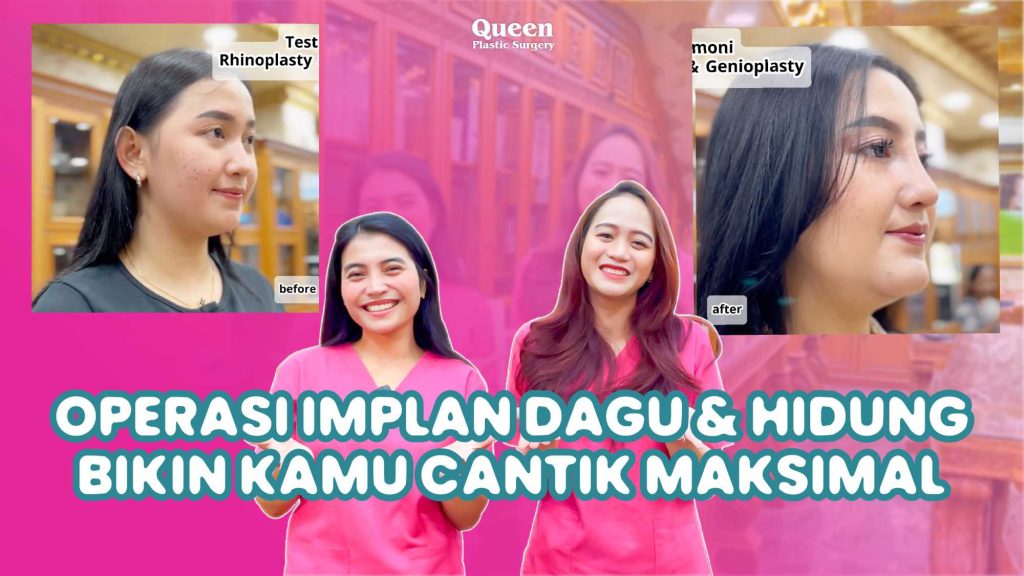 Dagu Lebih Menonjol atau Rahang Lebih Tegas? Kenali Implan Dagu vs. Implan Rahang di Sini!