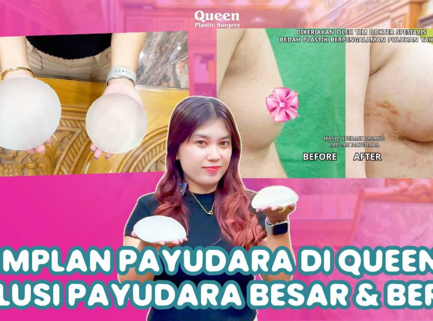Tips Aman Mengemudi Pasca Operasi Implan Payudara