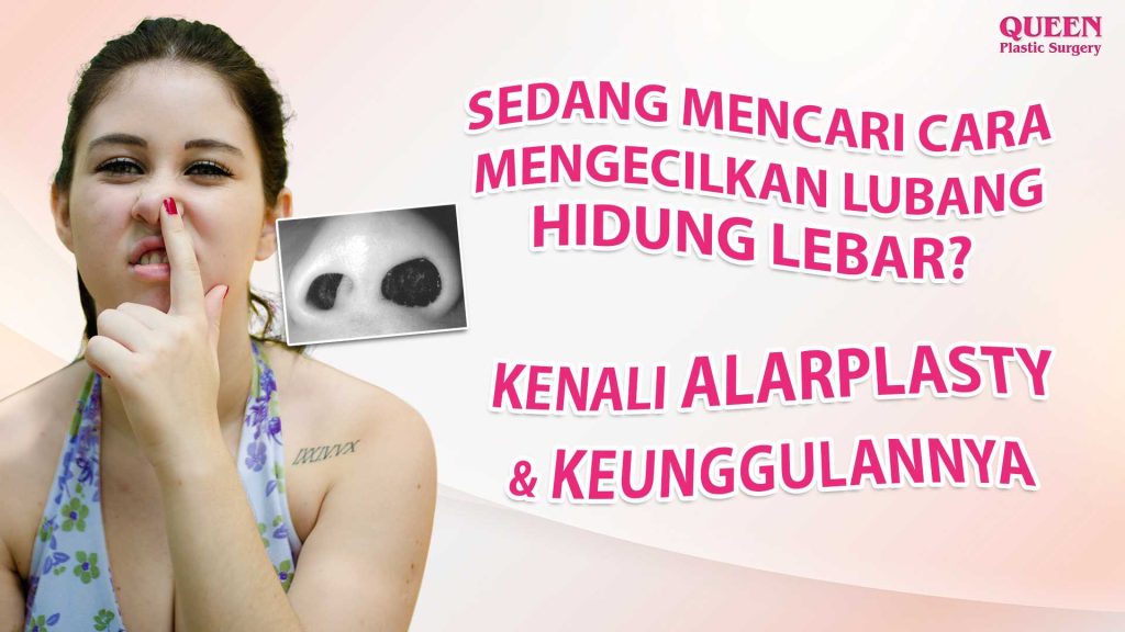 Sedang Mencari Cara Mengecilkan Lubang Hidung Lebar? Kenali Alarplasty dan Keunggulannya