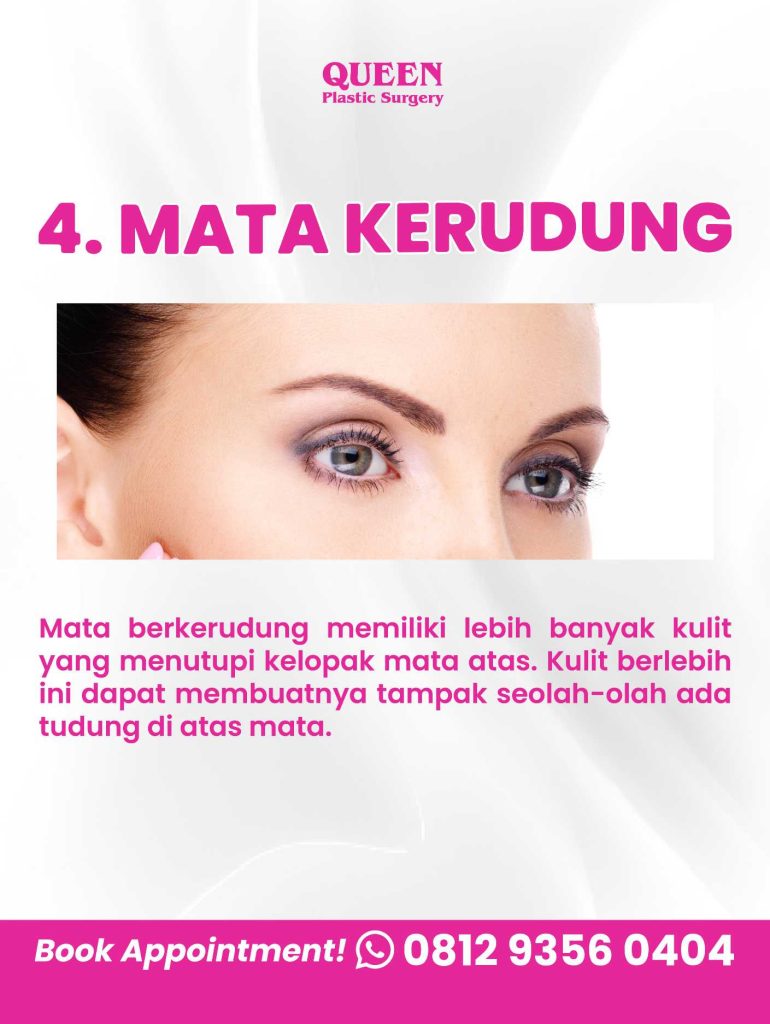 Rahasia Mata Indah: Apakah Pengangkatan Alis Mempengaruhi Bentuk Mata?
