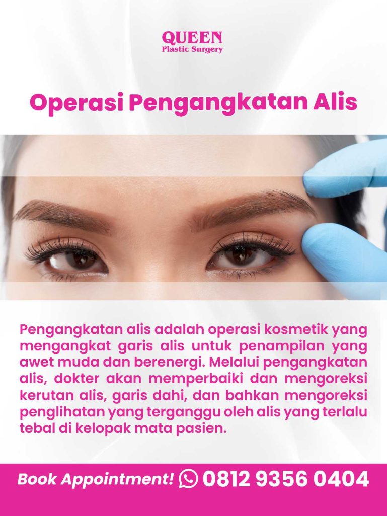 Rahasia Mata Indah: Apakah Pengangkatan Alis Mempengaruhi Bentuk Mata?