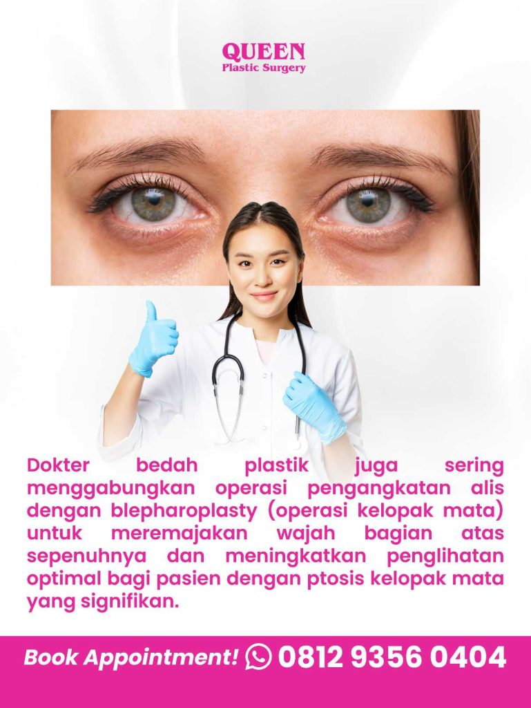 Rahasia Mata Indah: Apakah Pengangkatan Alis Mempengaruhi Bentuk Mata?