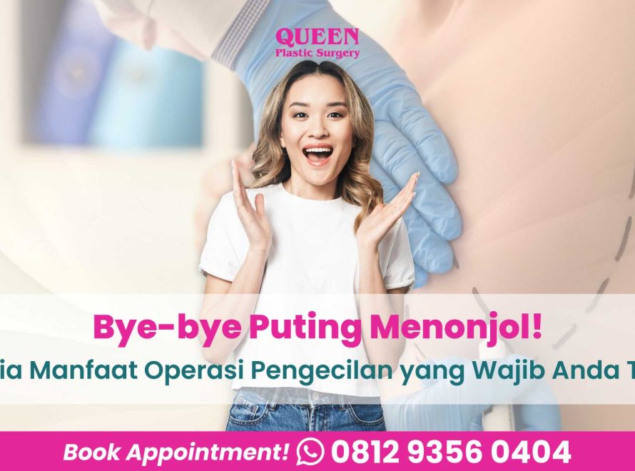 Bye-bye Puting Menonjol! Ini Dia Manfaat Operasi Pengecilan Puting yang Wajib Anda Tahu
