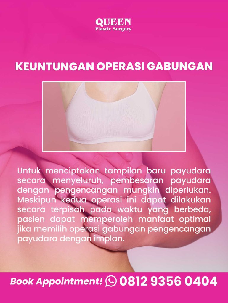 Tertarik Operasi Pengencangan dengan Implan? Pelajari Dulu Kelebihan dan Kekurangannya!
