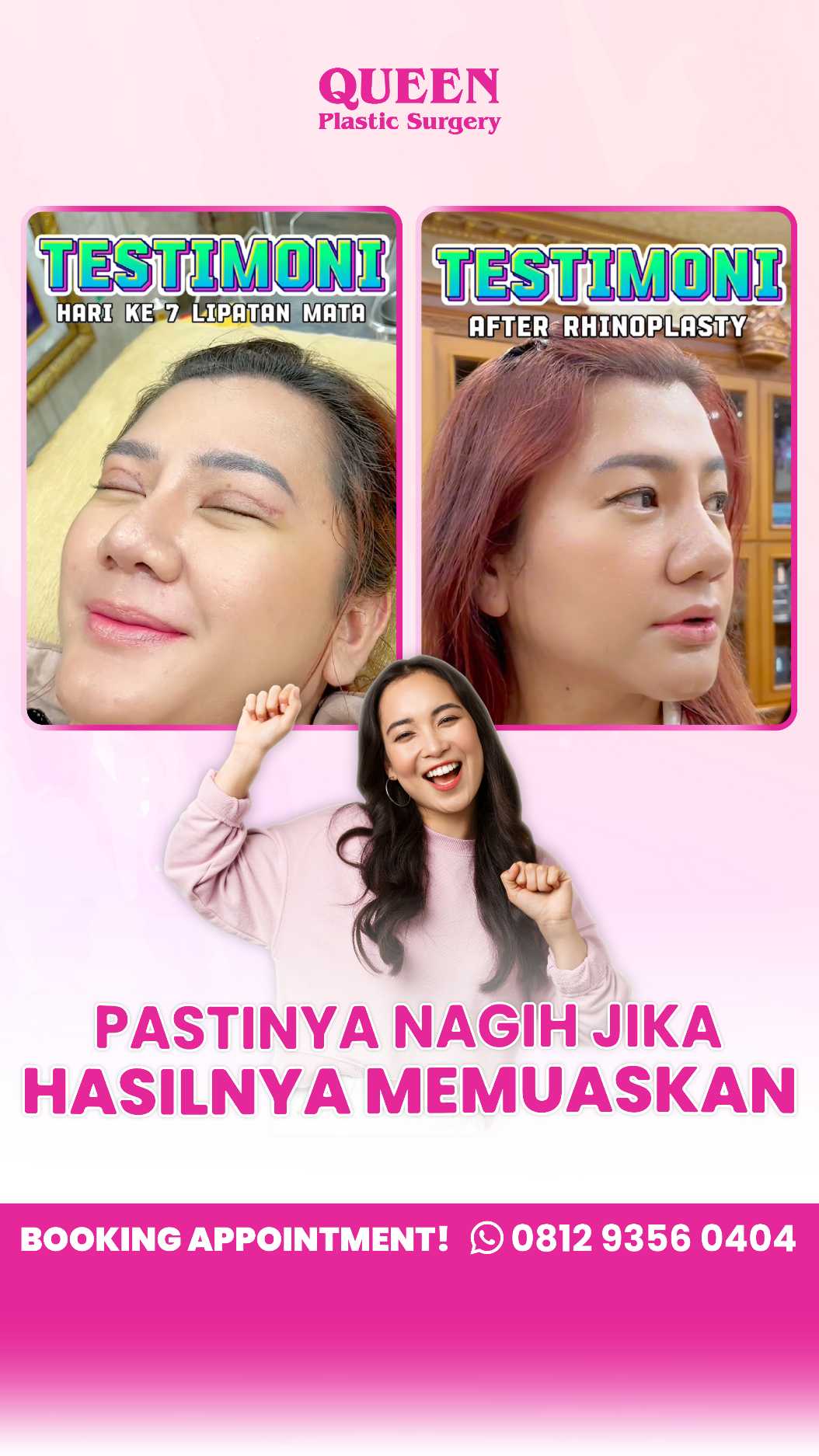 Menggabungkan Rhinoplasty dengan Prosedur Bedah Plastik Lain untuk Estetika Wajah Menyeluruh