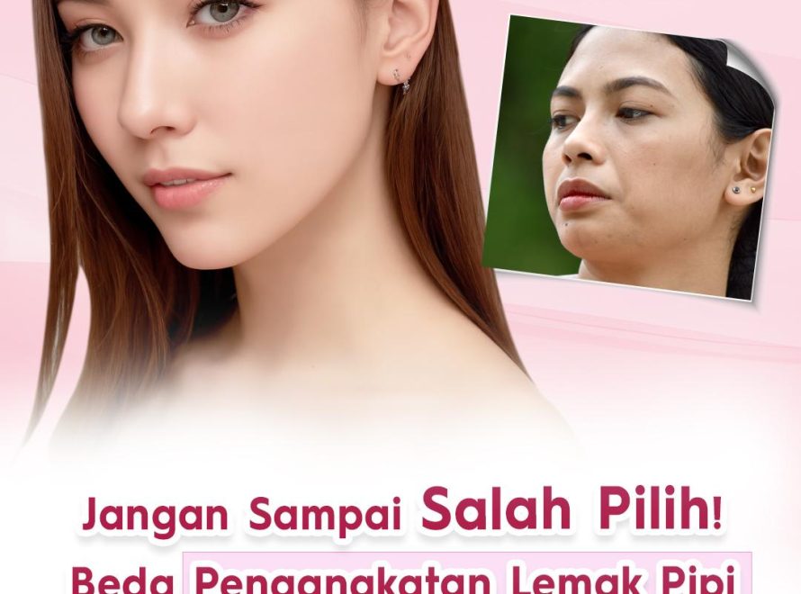 Jangan Sampai Salah Pilih! Ini Beda Pengangkatan Lemak Pipi dan Sedot Lemak Pipi