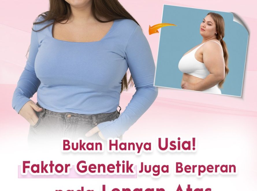 Bukan Hanya Usia! Faktor Genetik Juga Berperan pada Lengan Atas Kendur