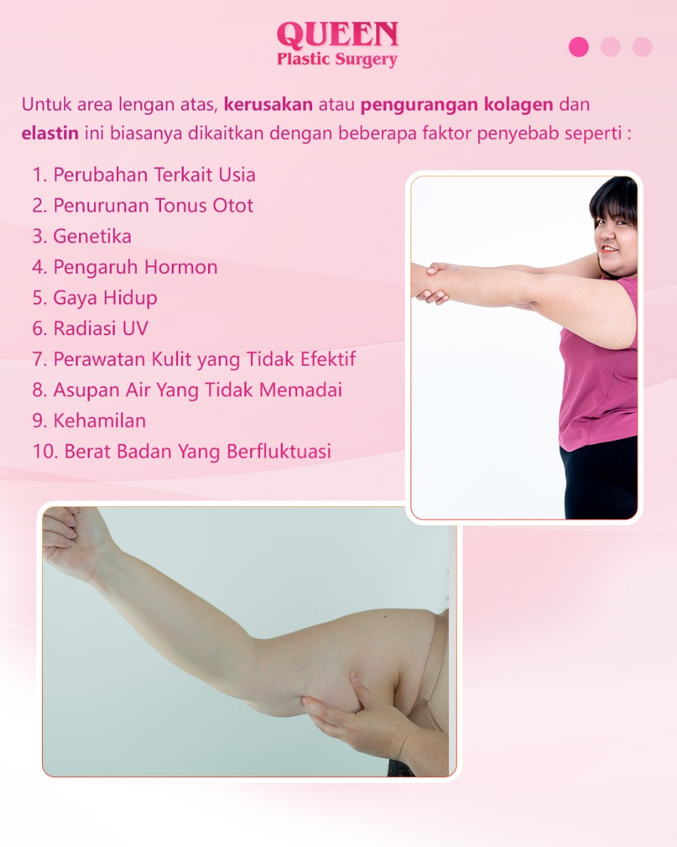 Bukan Hanya Usia! Faktor Genetik Juga Berperan pada Lengan Atas Kendur