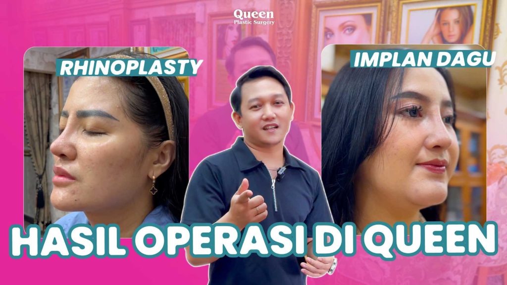 Sakit Kepala dan Nyeri Hebat Setelah Operasi Hidung? Jangan Khawatir, Ini Cara Ampuh Meredakannya!
