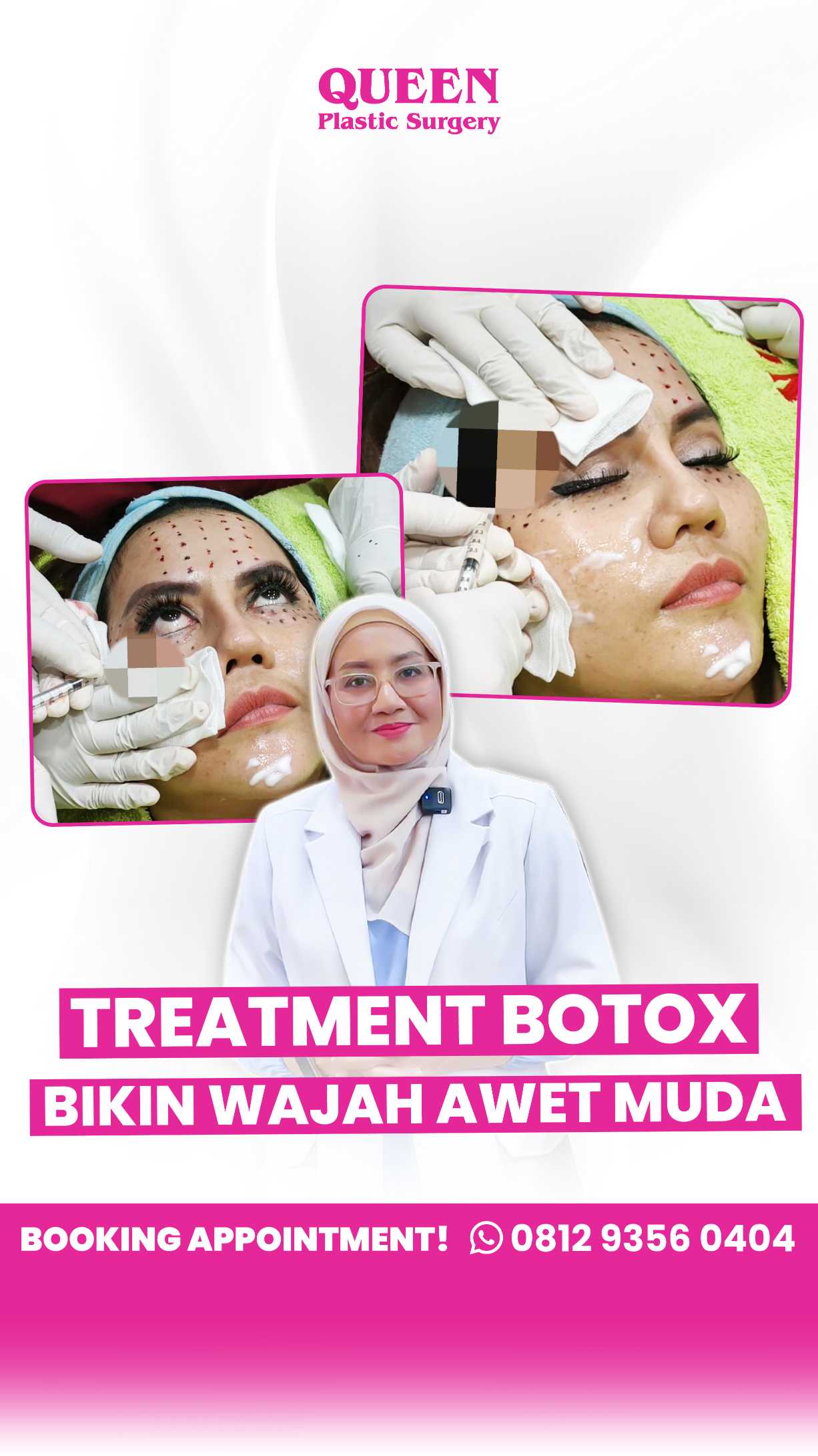 Bukan Hanya Filler, Botox Juga Bisa Bikin Hidung Lebih Ramping!