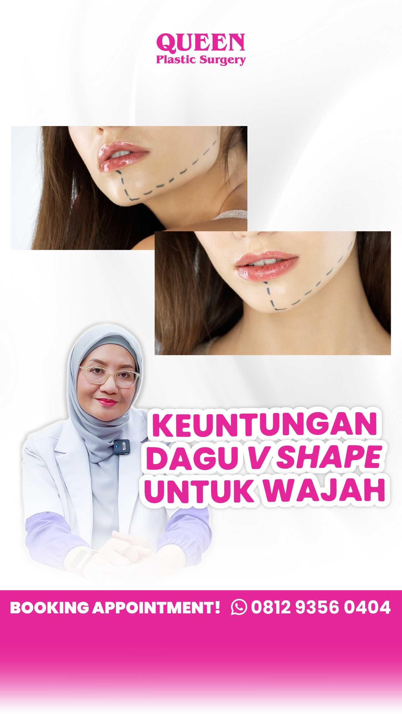 Dagu Ideal & Wajah Lebih Harmonis dengan Implan Dagu