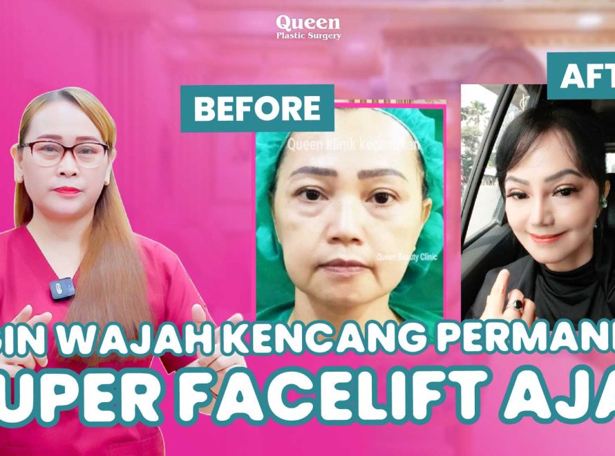Mengenal Manfaat Kombinasi untuk Wajah dan Leher Kencang Dengan Facelift dan Necklift