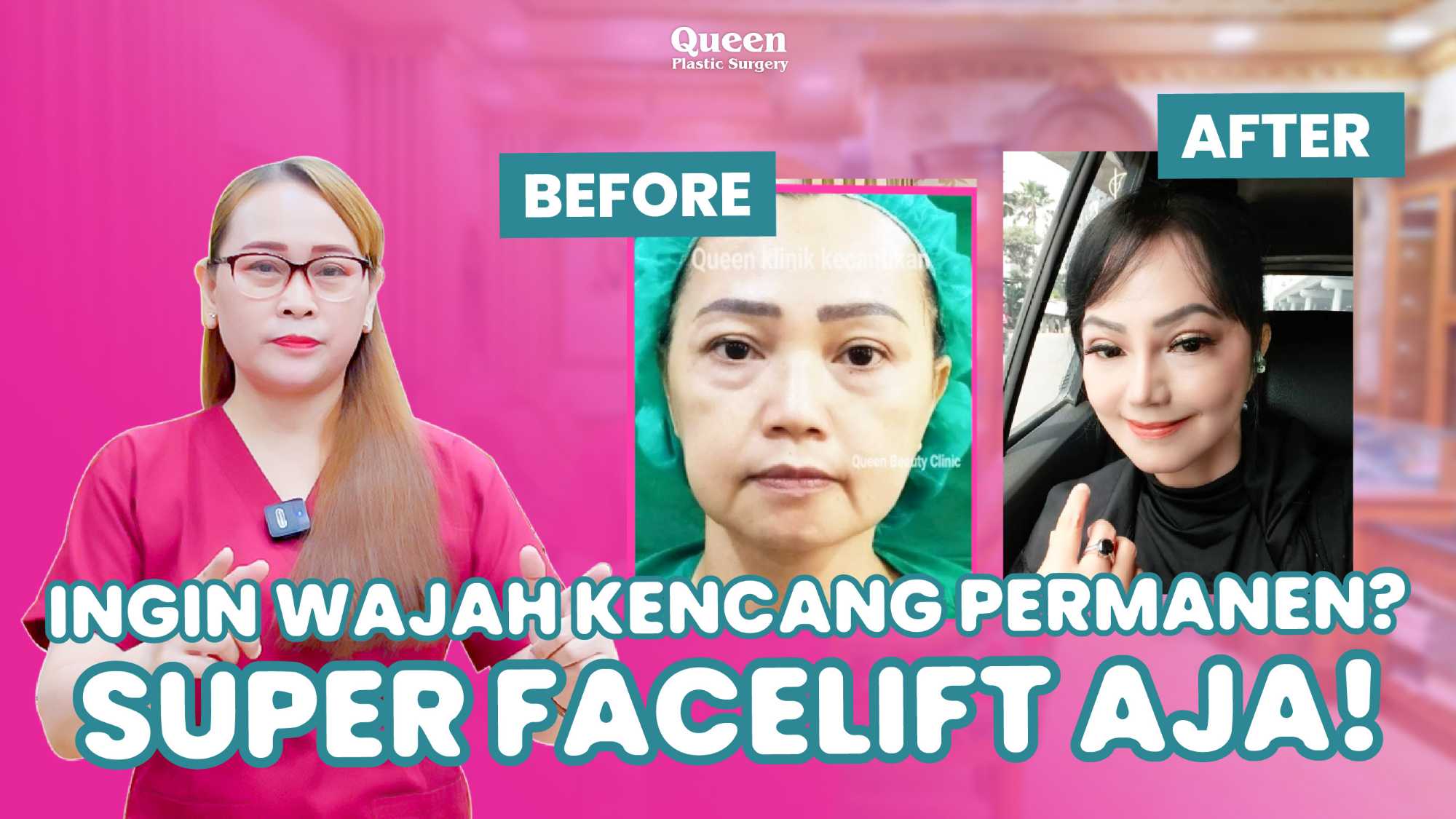 Mengenal Manfaat Kombinasi untuk Wajah dan Leher Kencang Dengan Facelift dan Necklift