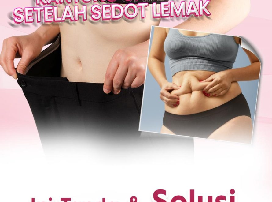 Waspada Kantung Cairan Seroma Setelah Sedot Lemak: Ini Tanda dan Solusi Penanganannya