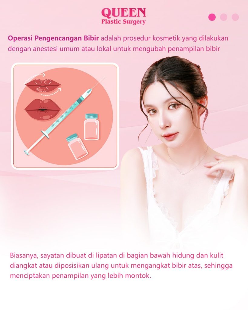 Manfaat Lip Lift: Rahasia Bibir Penuh dan Awet Muda Tanpa Filler Berulang