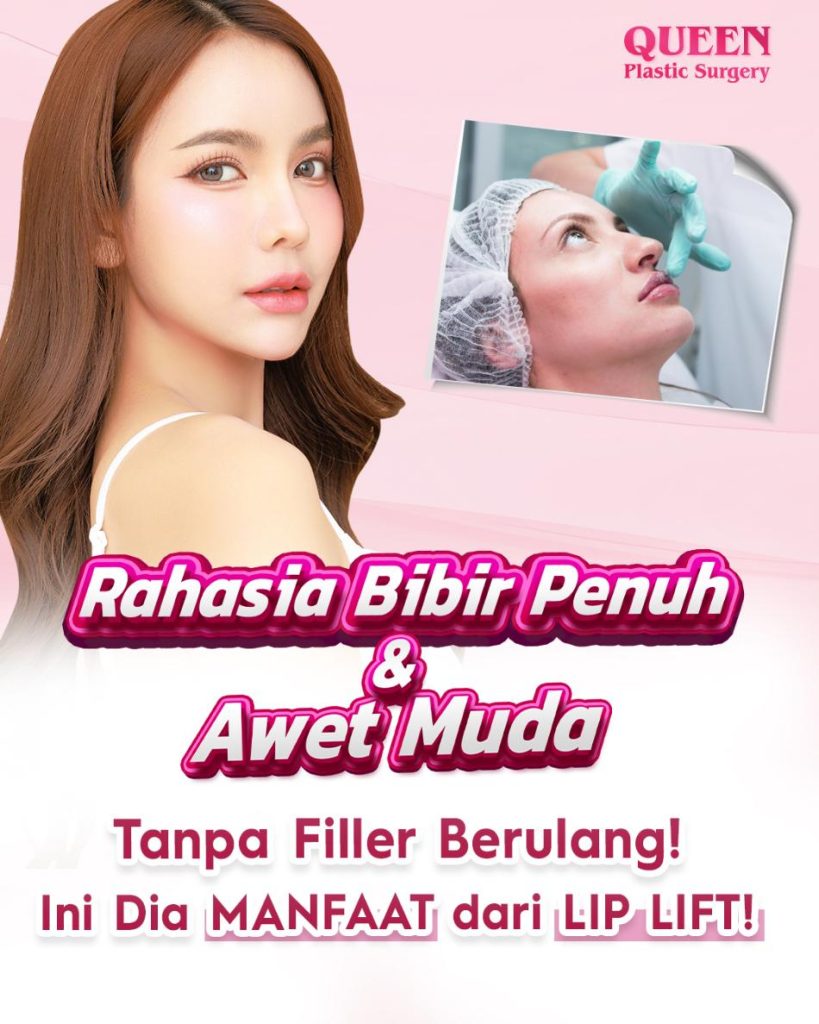 Manfaat Lip Lift: Rahasia Bibir Penuh dan Awet Muda Tanpa Filler Berulang