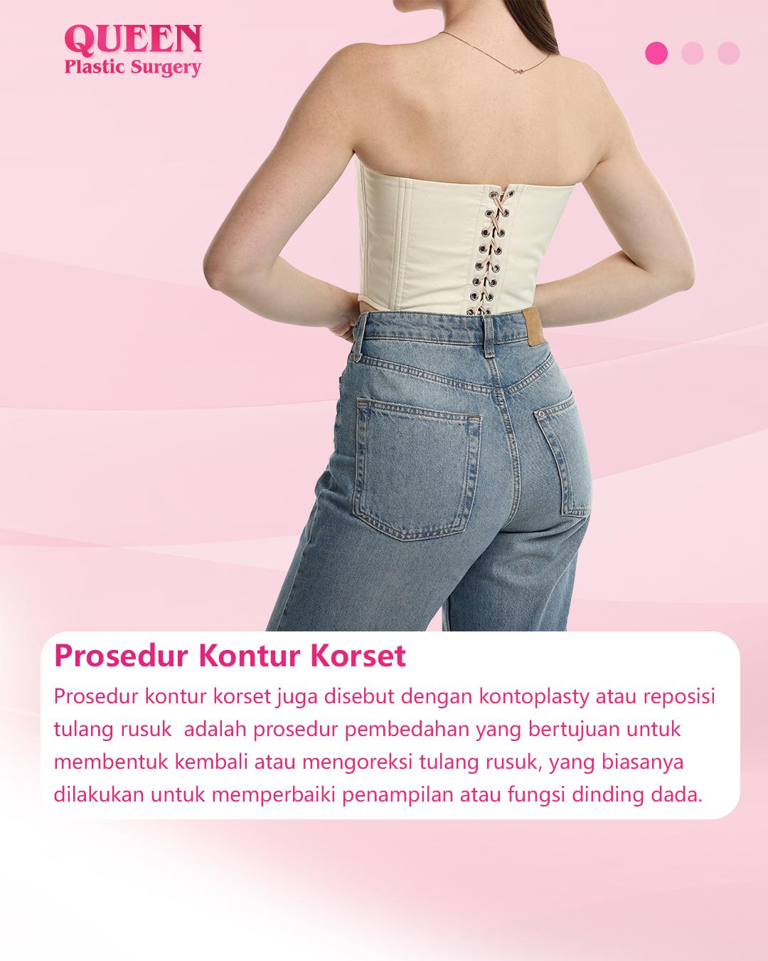 Kontur Korset: Solusi Efektif untuk Pembentukan Pinggang Ramping dan Tubuh Ideal