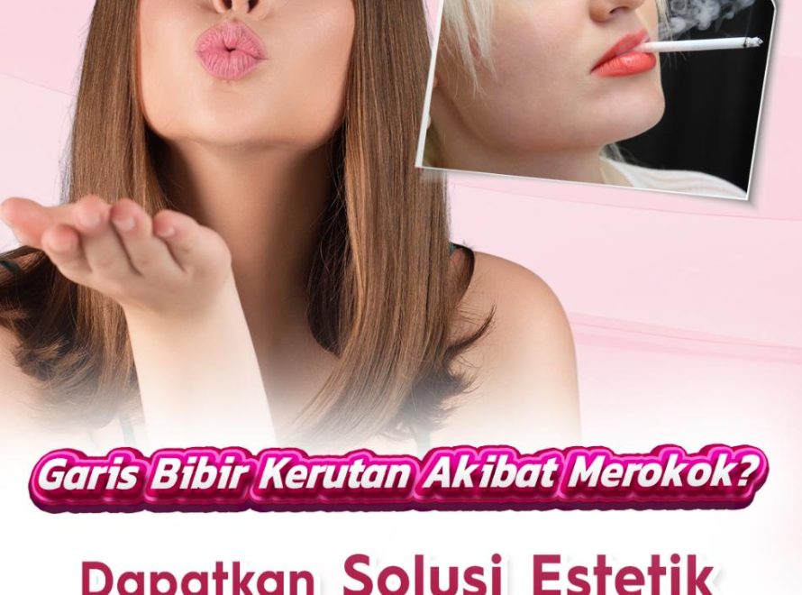 Garis Bibir Kerutan Akibat Merokok? Dapatkan Solusi Estetik Terbaik Pada Area Bibir dengan Operasi Plastik