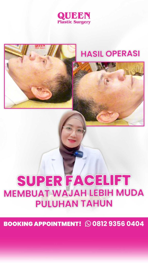 Mengapa Facelift dan Neck Lift Sering Dikombinasikan? Kelebihan & Kekurangan yang Wajib Anda Tahu