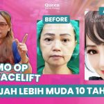 Operasi Facelift pada Pria vs. Wanita: Apa yang Membedakan Keduanya?