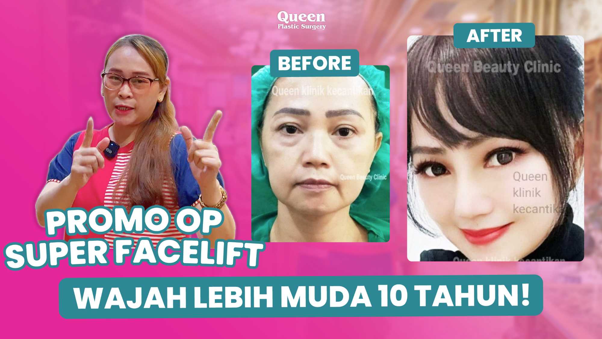 Mengapa Facelift dan Neck Lift Sering Dikombinasikan? Kelebihan & Kekurangan yang Wajib Anda Tahu