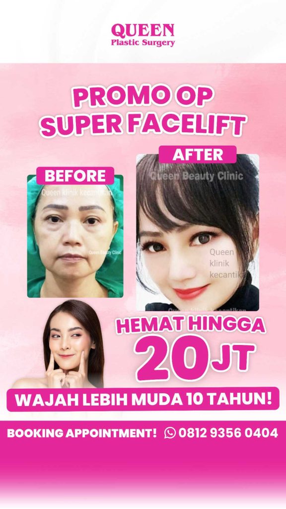 Hasil Maksimal! Keuntungan Menjalani Operasi Facelift dan Neck Lift Secara Bersamaan