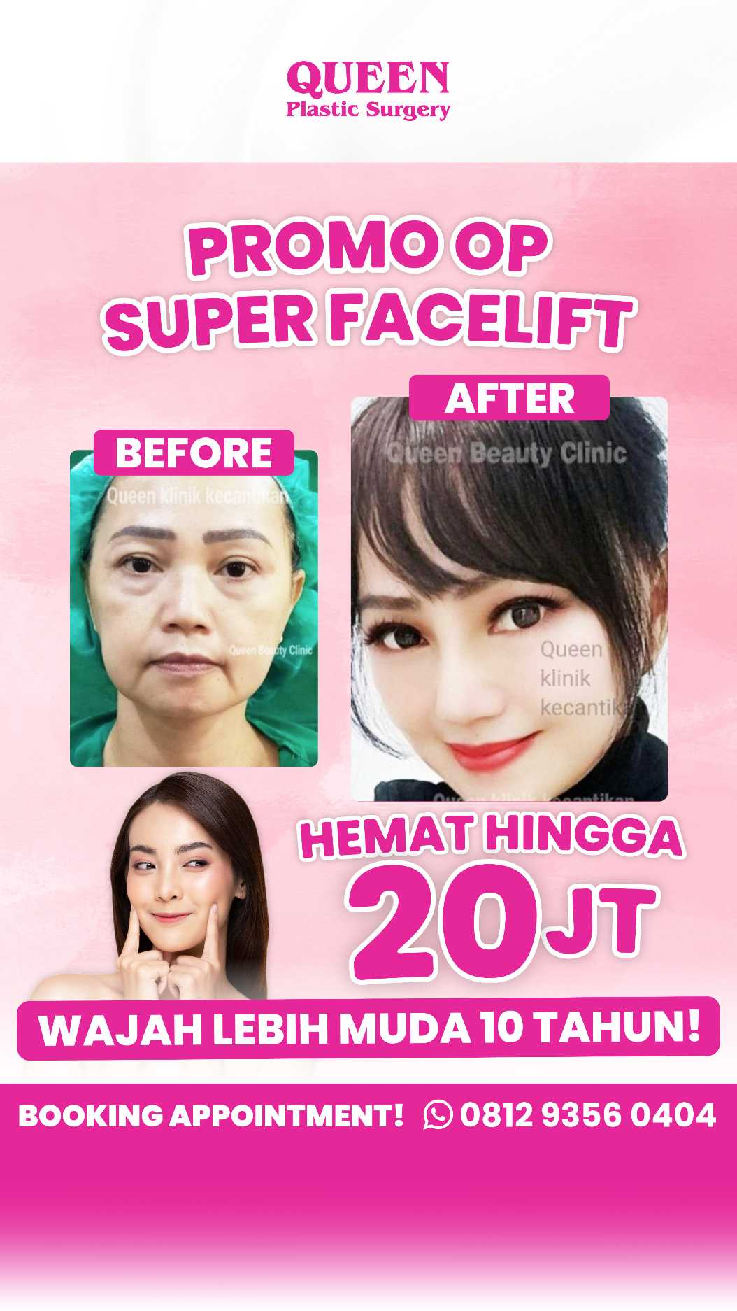 Menggabungkan Facelift Dan Transfer Lemak Wajah: Dapatkan Manfaatnya Untuk Wajah Kencang dan Bervolume Alami