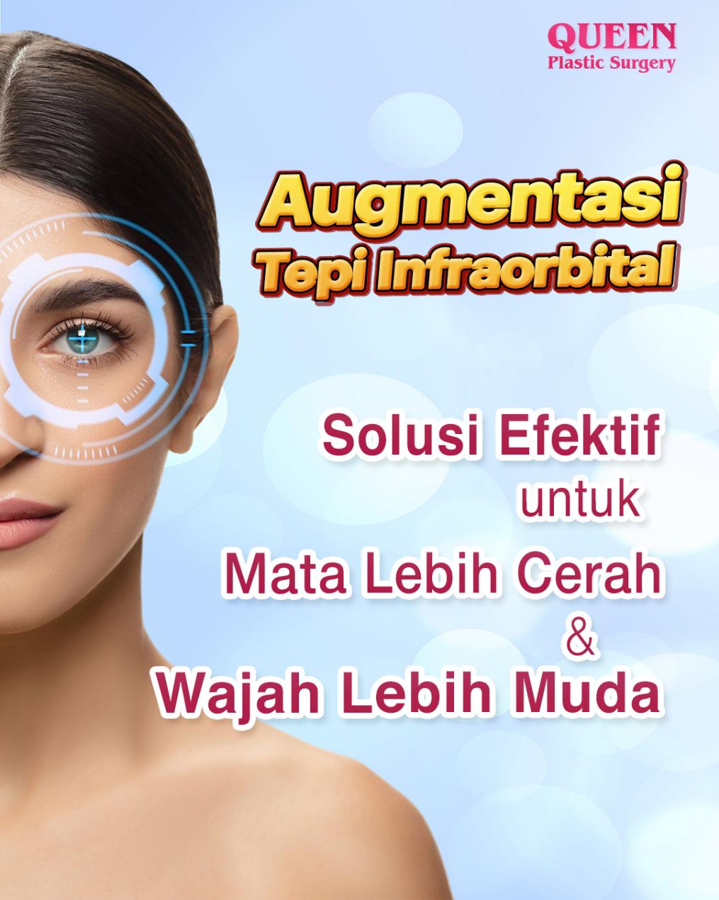 Augmentasi Tepi Infraorbital (Implan): Solusi Efektif untuk Mata Lebih Cerah dan Wajah Lebih Muda