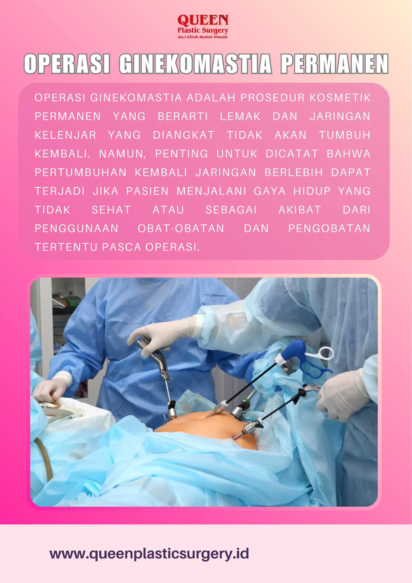 Mungkinkah Ginekomastia Tumbuh Lagi Pasca-Operasi? Jawaban Lengkap di Sini!