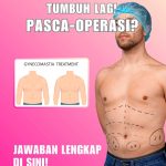 Pelipis Cekung Bikin Wajah Tampak Tua? Implan Temporal Jawabannya!