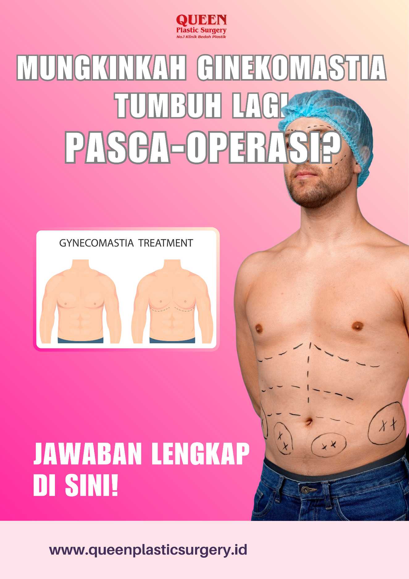 Pelipis Cekung Bikin Wajah Tampak Tua? Implan Temporal Jawabannya!