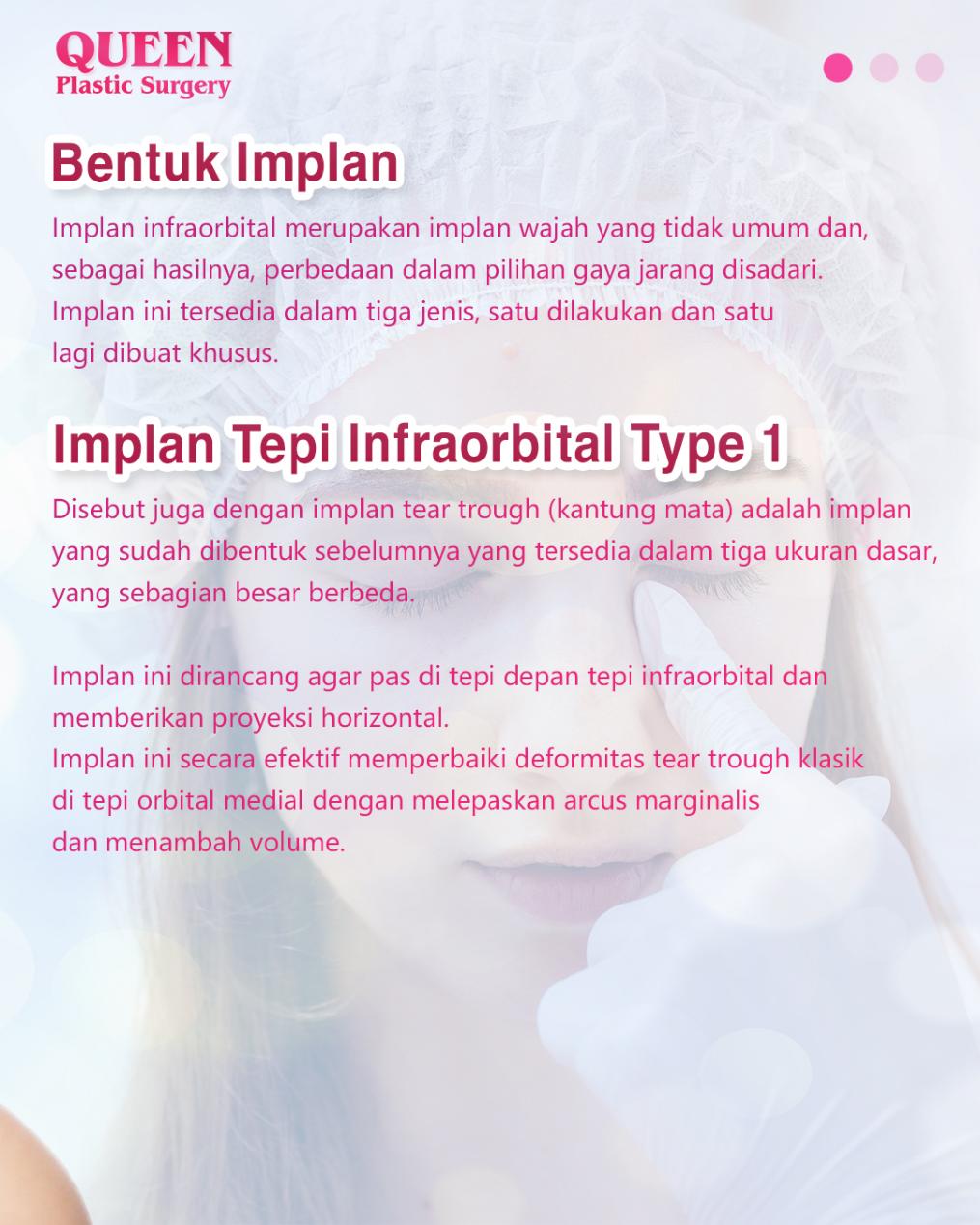 Memahami Bentuk dan Indikasi Implan Tepi Infraorbital Untuk Solusi Mata Cekung