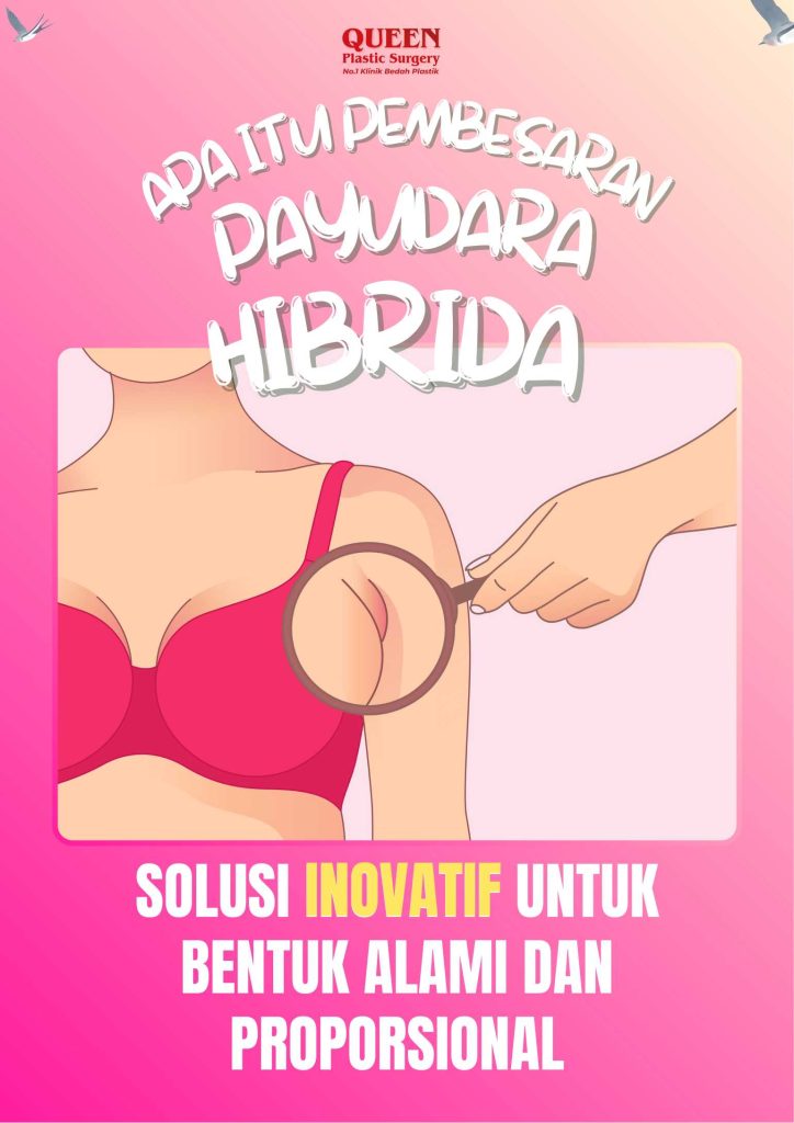 Apa Itu Pembesaran Payudara Hibrida? Solusi Inovatif untuk Bentuk Alami dan Proporsional