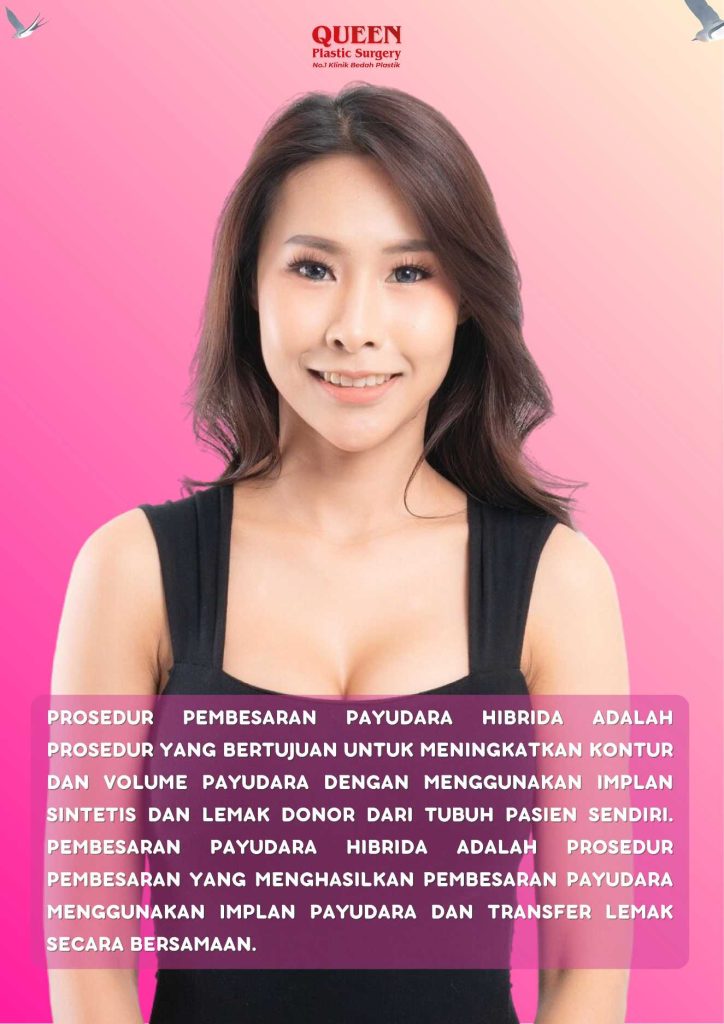 Apa Itu Pembesaran Payudara Hibrida? Solusi Inovatif untuk Bentuk Alami dan Proporsional