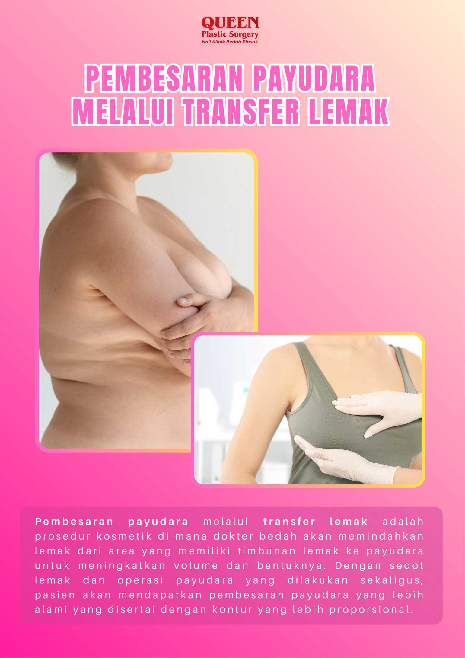 Pembesaran Payudara Tanpa Implan? Kenali Alternatif Baru yang Inovatif di Sini!