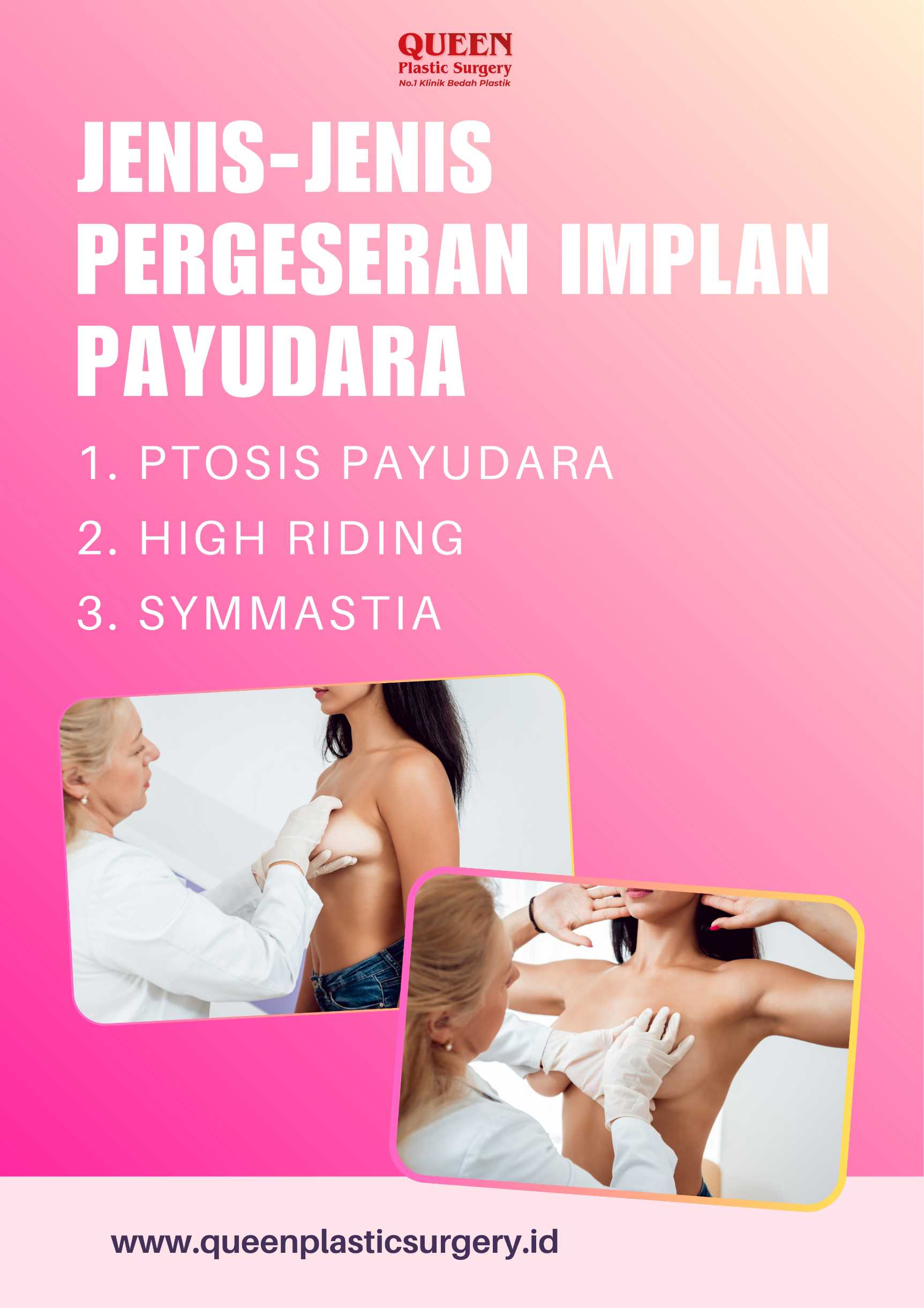 Implan Payudara Bergeser ke Luar? Pahami Cara Mengatasi Pergeseran Implan Payudara