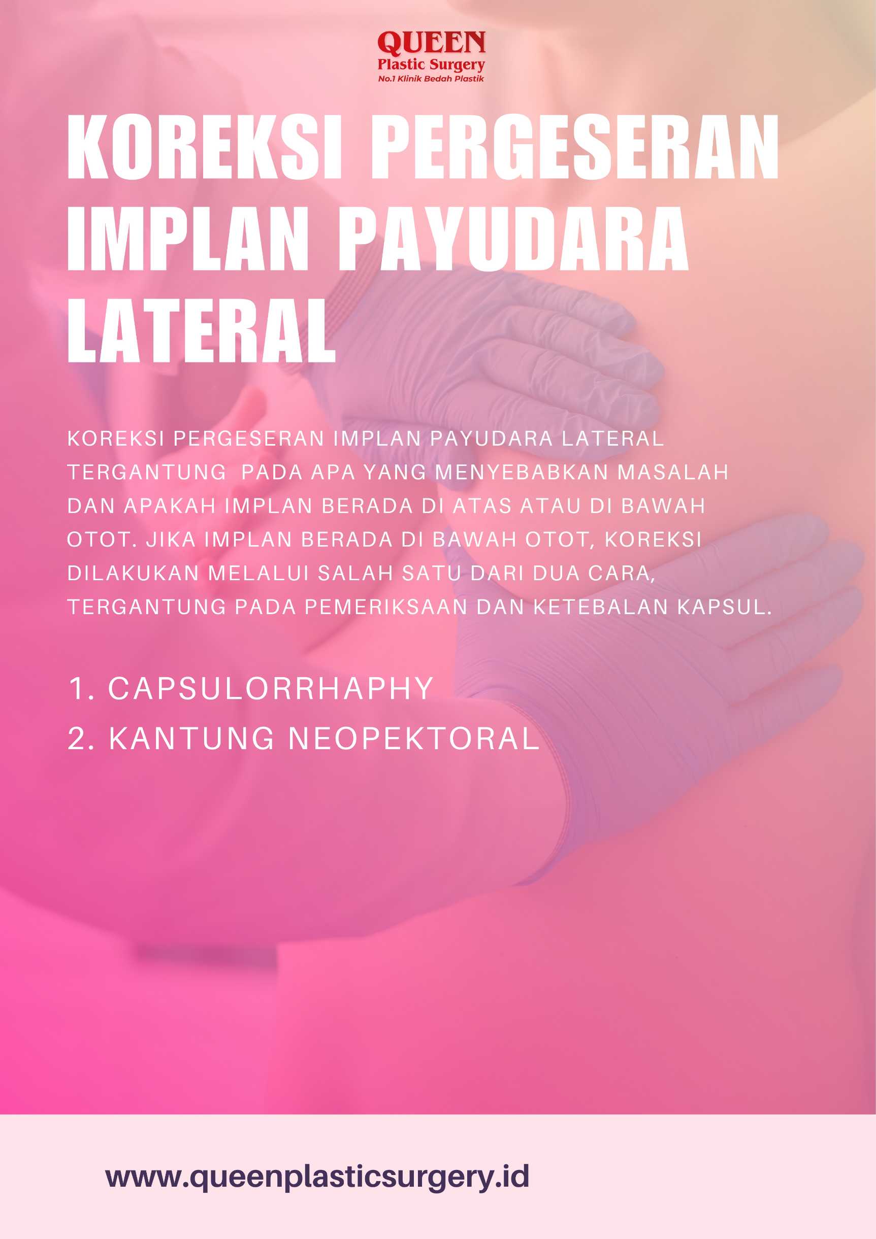 Implan Payudara Bergeser ke Luar? Pahami Cara Mengatasi Pergeseran Implan Payudara