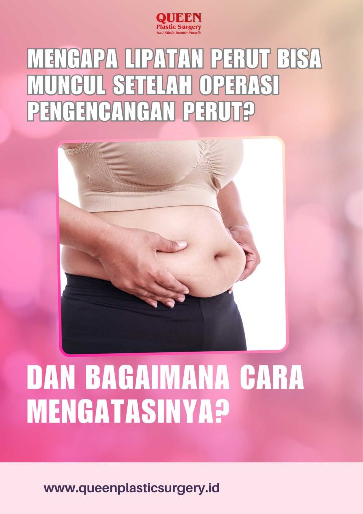 Mengapa Lipatan Perut Bisa Muncul Setelah Operasi Pengencangan Perut? dan Bagaimana Cara Mengatasinya?