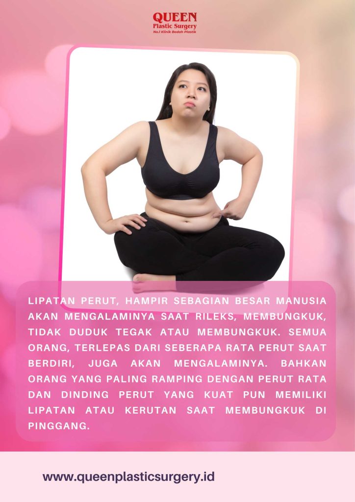 Mengapa Lipatan Perut Bisa Muncul Setelah Operasi Pengencangan Perut? dan Bagaimana Cara Mengatasinya?