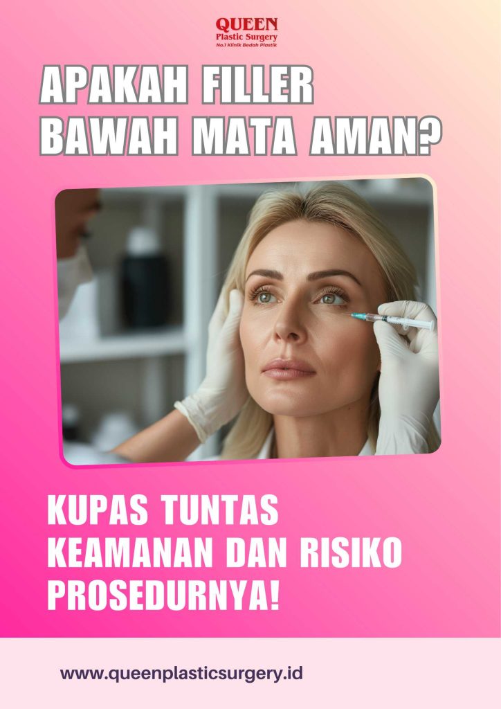 Apakah Filler Di Bawah Mata Aman? Kupas Tuntas Keamanan dan Risiko Prosedurnya!